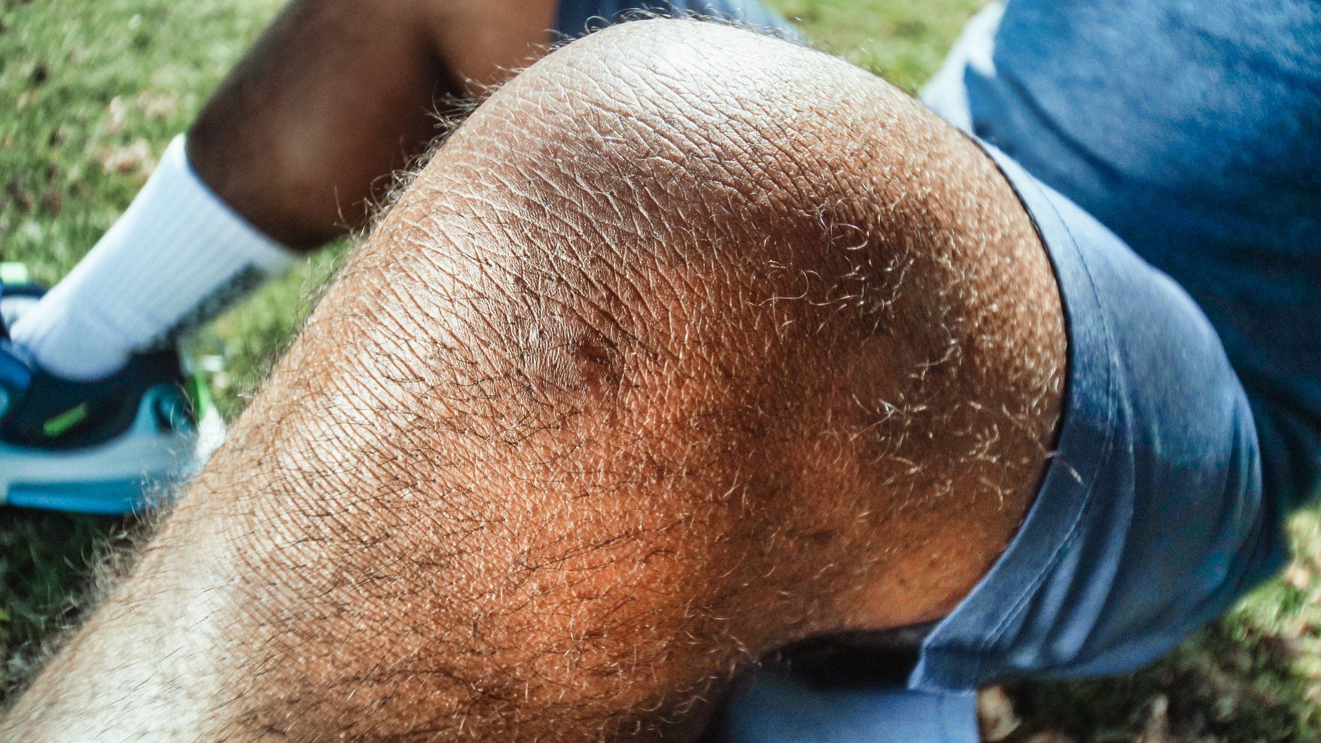 Knee pain affecting everyday movement